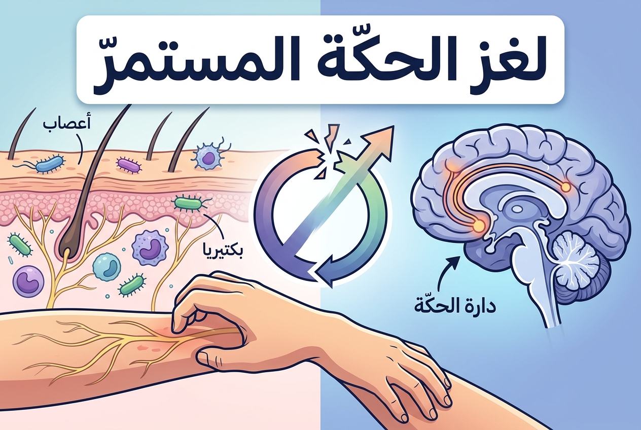 لماذا نحكّ ولا نستطيع الكفّ عن الحكّ